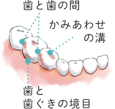 歯と歯の間、かみあわせの溝、歯と歯ぐきの境目