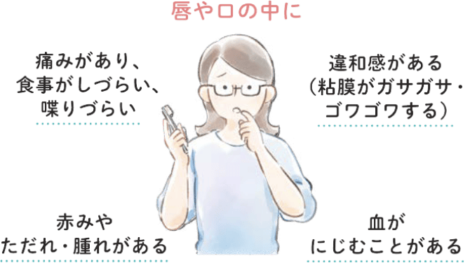 唇や口の中に痛みがあり、食事がしづらい、喋りづらい、赤みやただれ・腫れがある、違和感がある(粘膜がガサガサ・ゴワゴワする)、血がにじむことがある